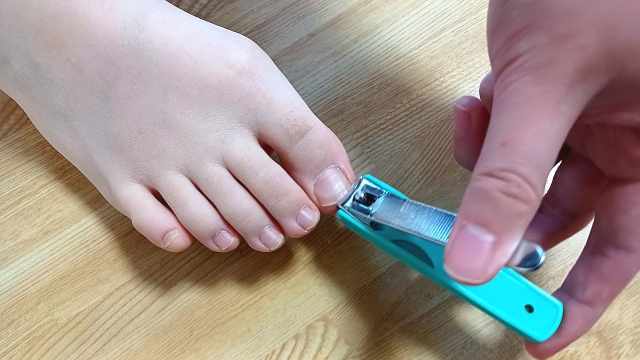 大船　巻き爪　爪切り