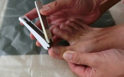 大船　巻き爪　爪切り