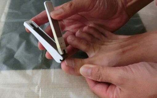 大船　巻き爪　爪切り