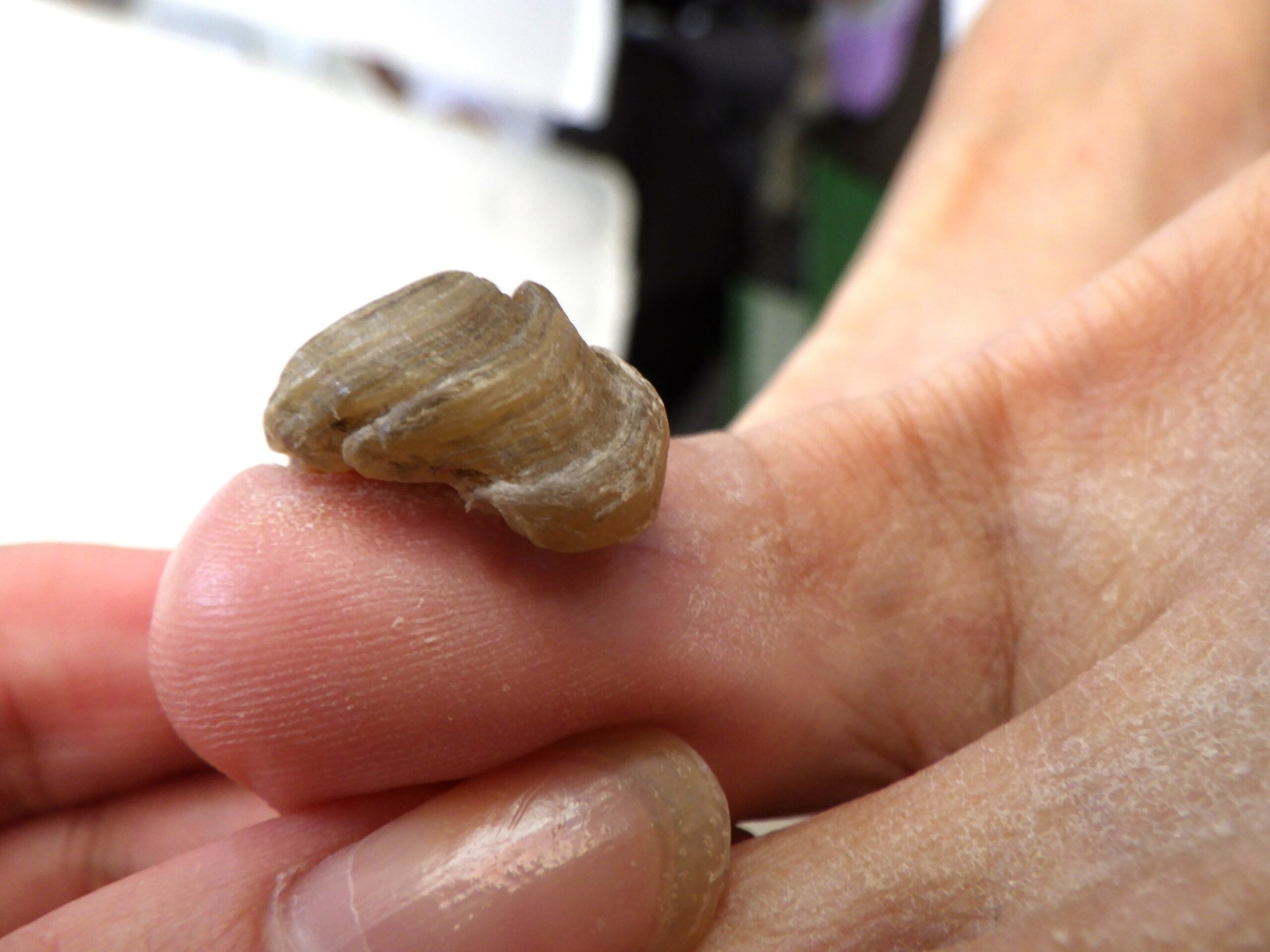 大船　巻き爪　変形爪