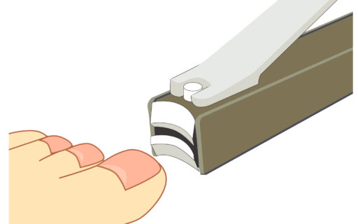 大船　巻き爪　爪切り