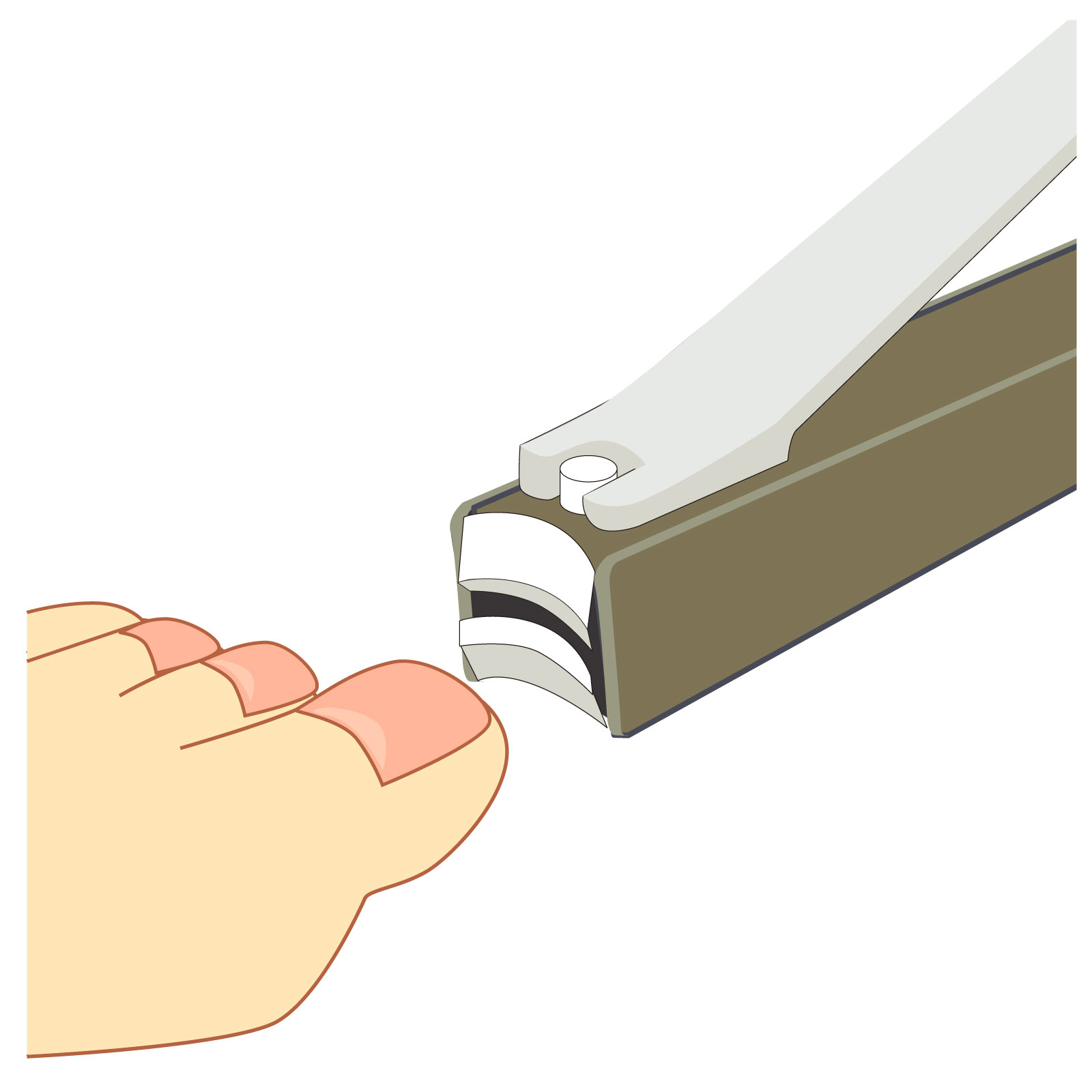 大船　巻き爪　爪切り