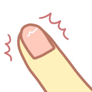 大船　巻き爪　割れ爪