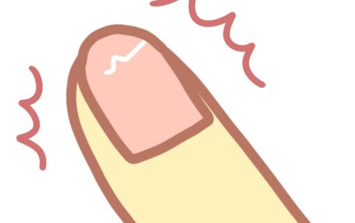 大船　巻き爪　割れ爪