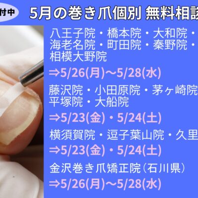 相模大野 巻き爪 無料相談会