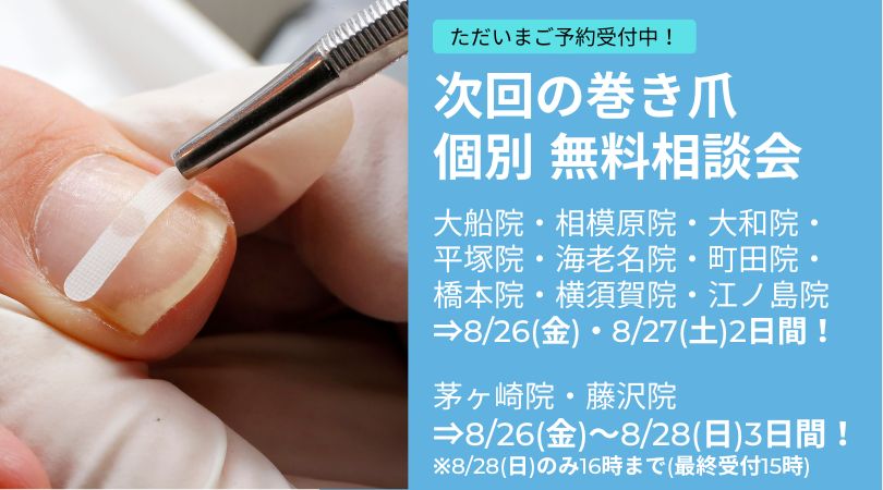 神奈川県 巻き爪 無料相談会