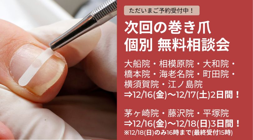 神奈川県 巻き爪 無料相談会