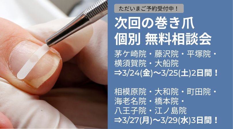 神奈川県 巻き爪 無料相談会