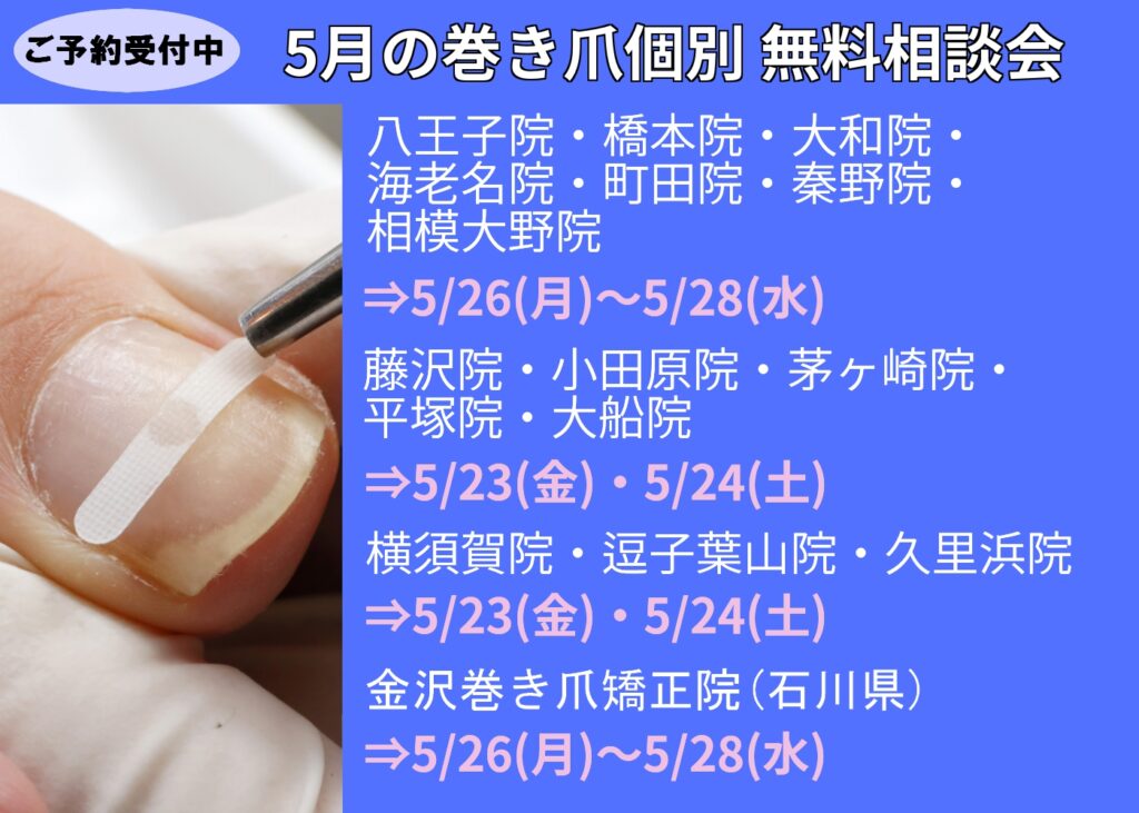 神奈川県 巻き爪 無料相談会