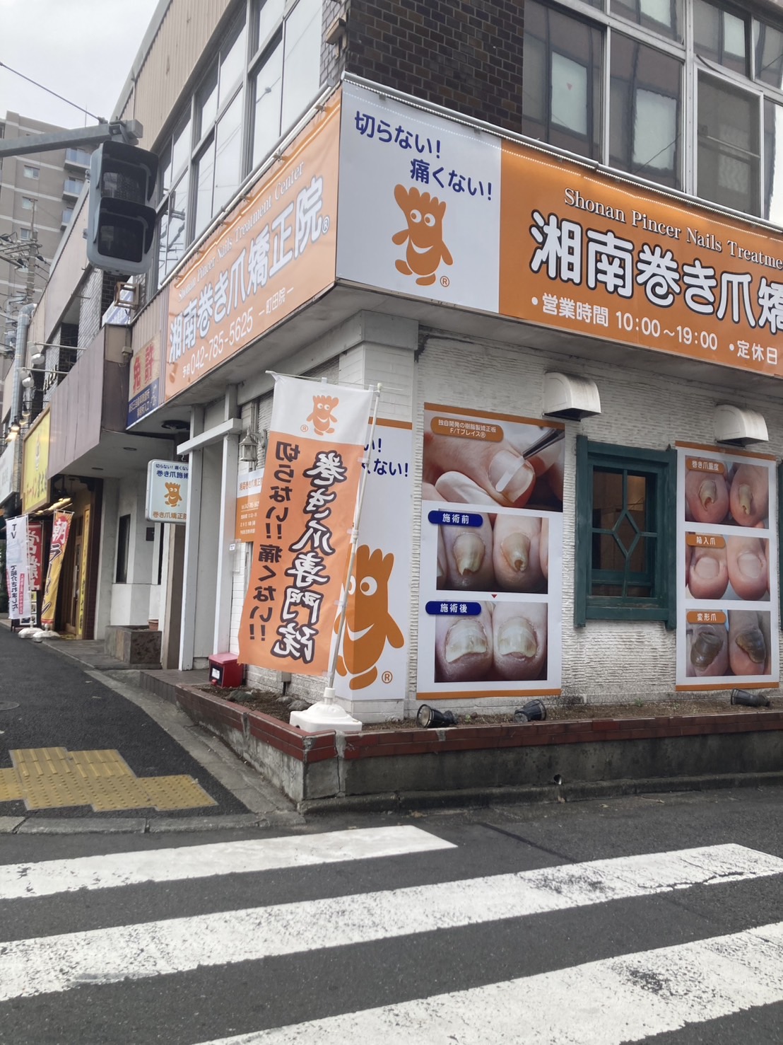 神奈川県　巻き爪　店舗