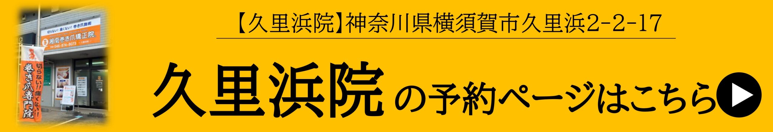 神奈川県　巻き爪　ネット予約