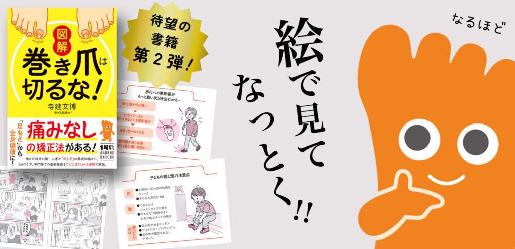 神奈川県　巻き爪　書籍