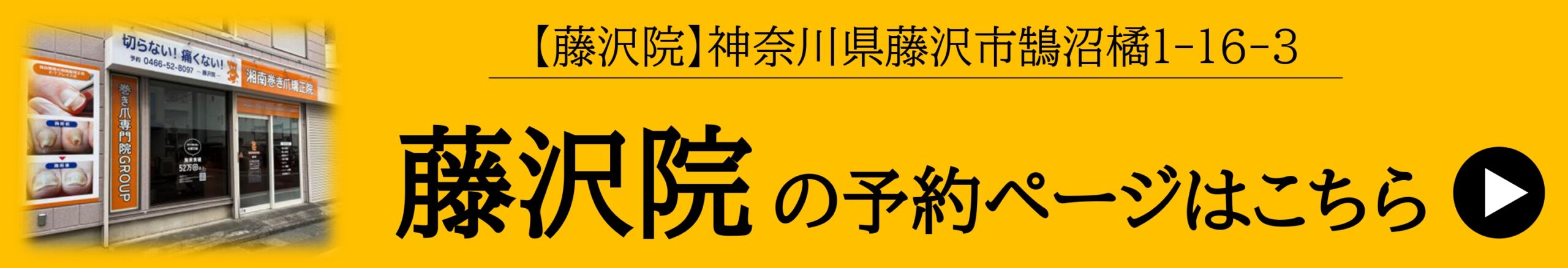 神奈川県　巻き爪　ネット予約