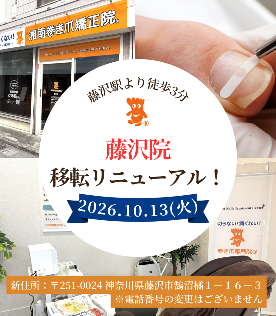 藤沢市　巻き爪　お知らせ