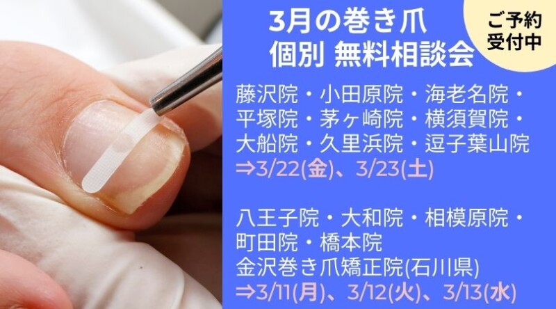 逗子市　巻き爪　無料相談会