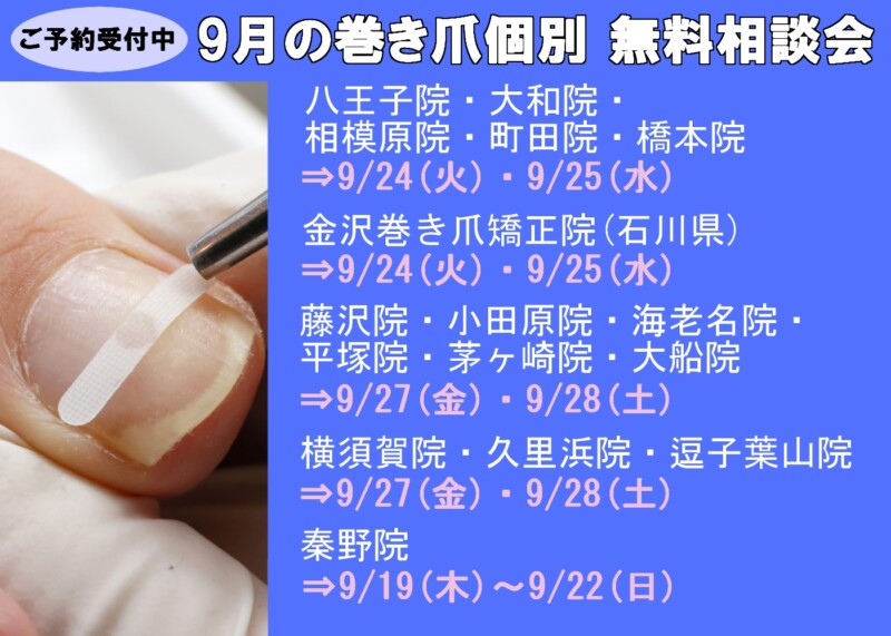 逗子市　巻き爪　無料相談会