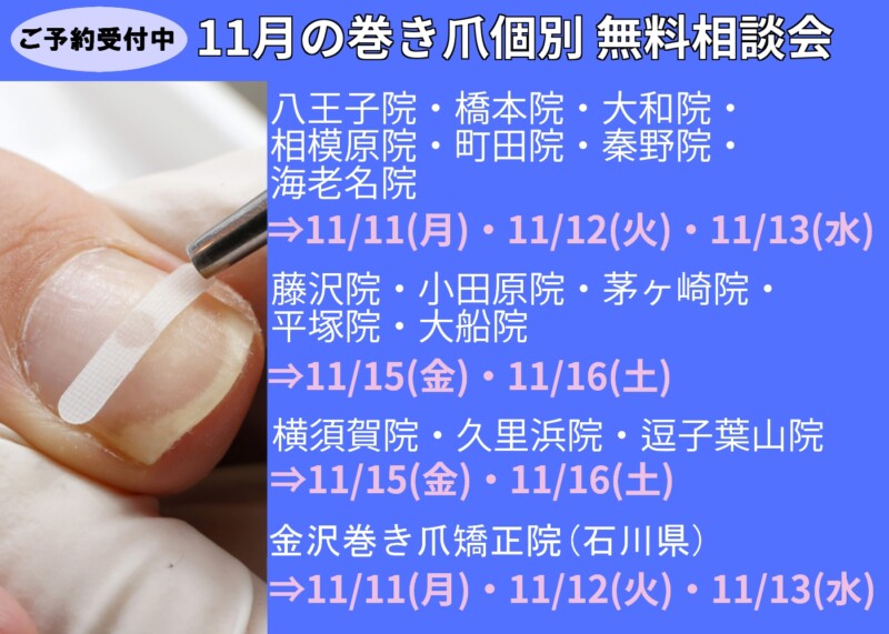 逗子市　巻き爪　無料相談会